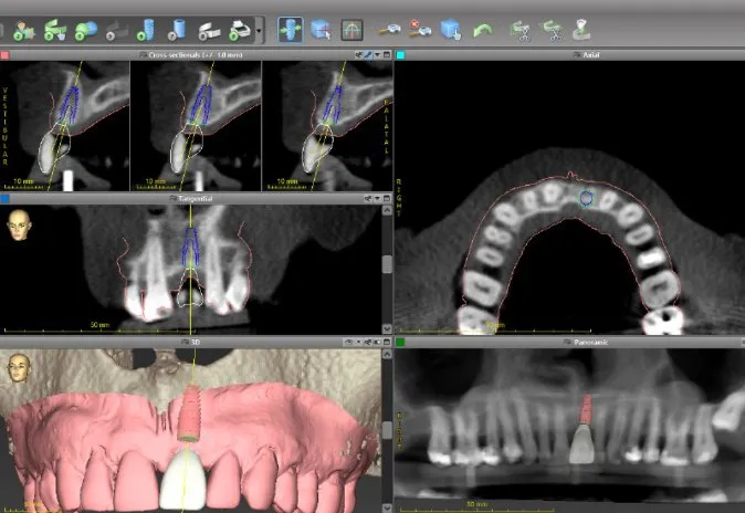 CoDiagnostix2